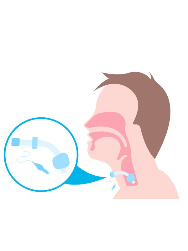 Silikonowa Rurka Tracheostomijna Servox Soft Tube 22mm Bez Fenestracji 10