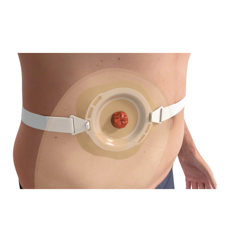 5028T PASEK STOMA CARE Pasek podtrzymujący sprzęt stomijny B. BRAUN