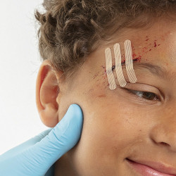 Leukoplast® STRIP - plastry do nieinwazyjnego zamykania ran 9 szt.