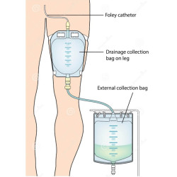 11061901 Worek Do zbiórki Moczu 0,35 L Dren 30 cm Leg Bag Premium Przezroczysty MBH QUFORA