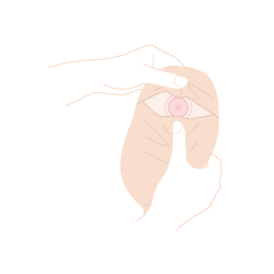 ACFXL115 Worek Stomijny Jednoczęściowa Zamknięty 15-70 mm Aurega 1 Closed Extra Duży Beżowy Cortmed