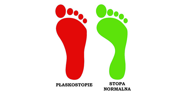 Kiedy przypada Dzień Inwalidy Wojennego? Co przysługuje inwalidom wojennym?