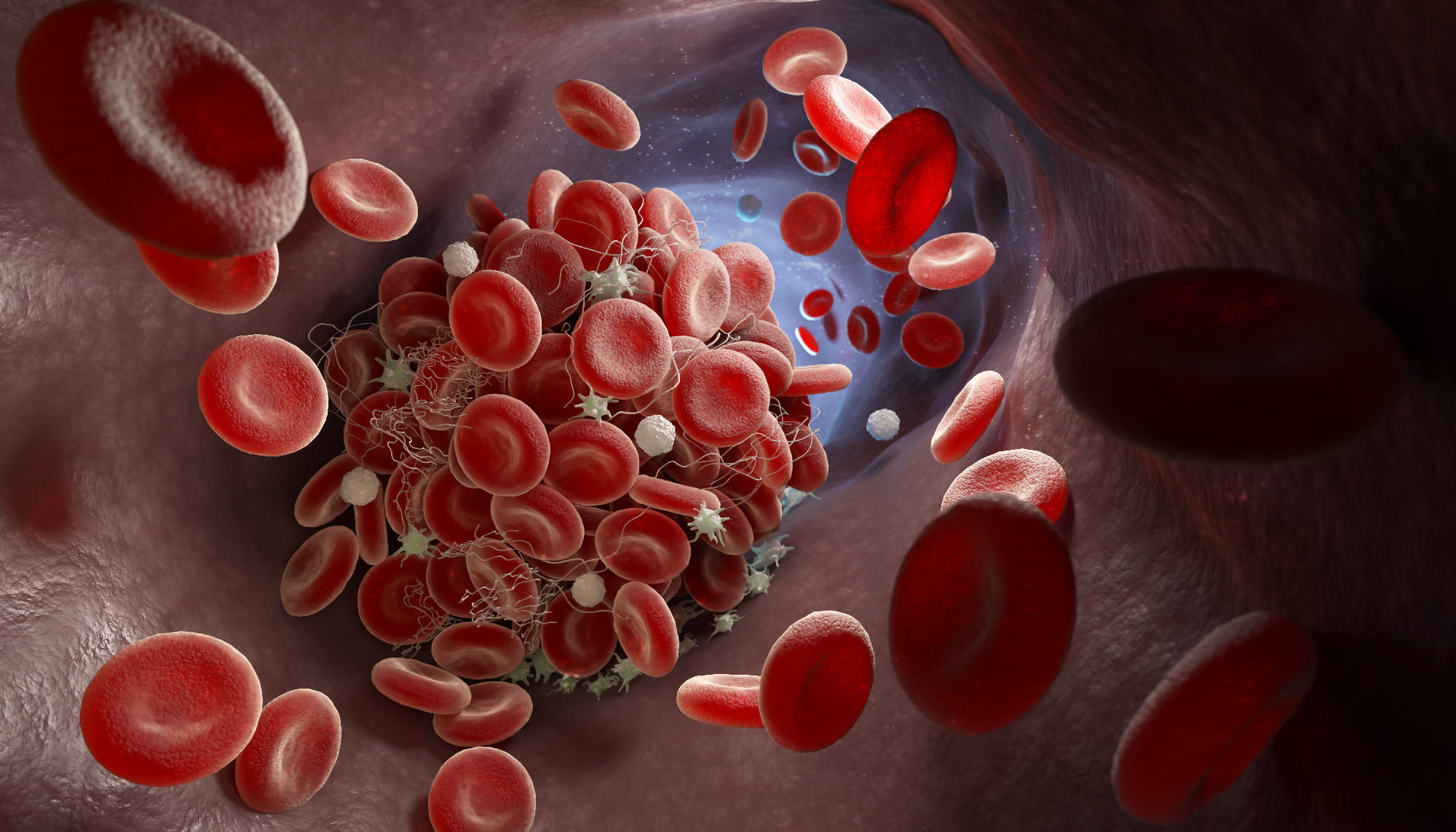 Leukocyturia – co oznaczają leukocyty w moczu?